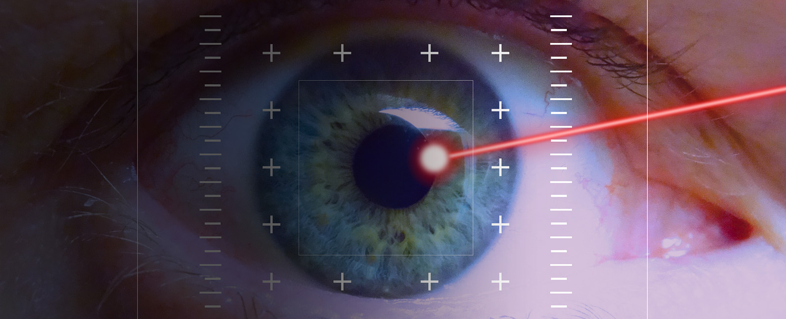 Micro Cirurgia Ocular Cl Nica Oftalmol Gica